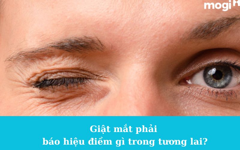 Giật Mắt Phải Ở Nam, Nữ Báo Hiệu Điềm Gì? Điềm Lành Hay Dữ?