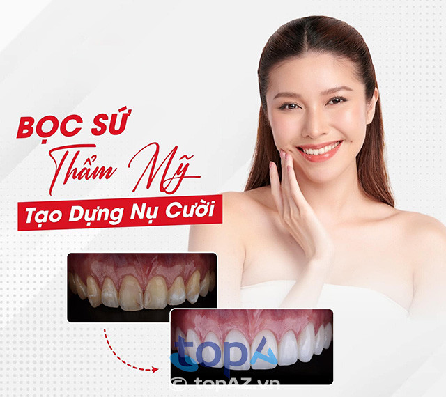 Top 5 Địa chỉ bọc răng sứ tại Nha Trang uy tín, chất lượng