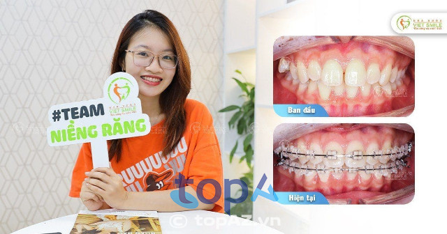 Top 5 Địa chỉ niềng răng tại Quận 10 uy tín, dịch vụ tốt nhất